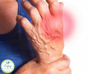 Best Essential Oils for Arthritis - 5 Best Essential Oils for Arthritis Pain & Inflammation (  Pain Relief Recipes) - Enjoy Natural Health