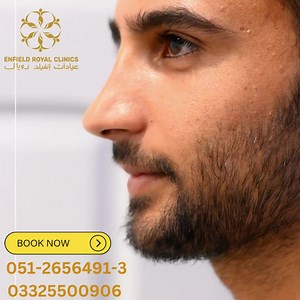 1.2K views · 70 reactions | Rhinoplasty (Nose Job) ✨ Rhinoplasty,...