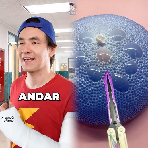 When I have to wear a cast on my arm...