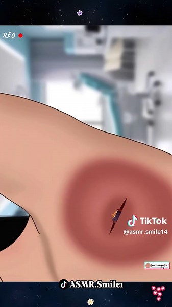 ASMR Treatment for Relaxation and Well-being