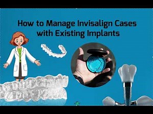 How to Manage an Invisalign Case with Existing Implants