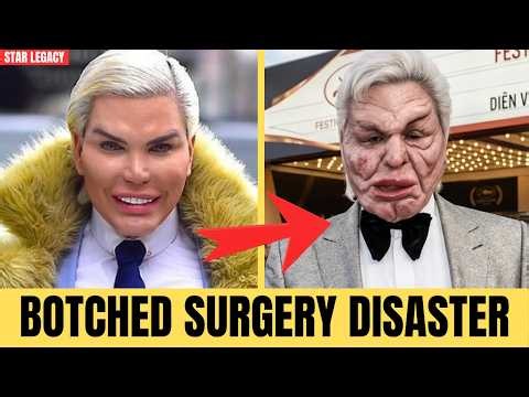 10 Worst Celebrity Plastic Surgery Disasters | Then and Now 2026