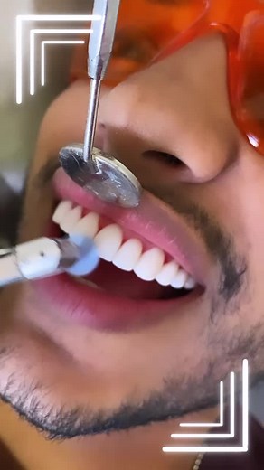 Dental Aesthetics: Facets and Orthodontics Explained