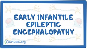 Early infantile epileptic encephalopathy (NORD): Video, Causes, & Meaning | Osmosis