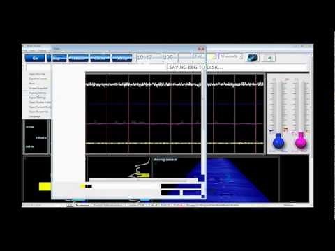 BrainMaster Technologies BrainAvatar Basics - Webinar #1 11-16-12