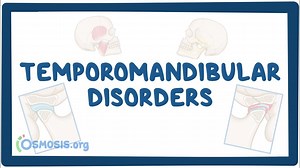 Temporomandibular joint dysfunction: Video, Causes, & Meaning | Osmosis