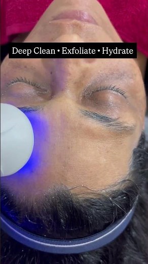 Hydra Facial result at Agastya Ayurveda skin Aesthetics