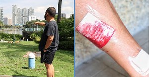 Man Bitten by an Otter 2m Away While Taking Video of a Group of Otters at Kallang
