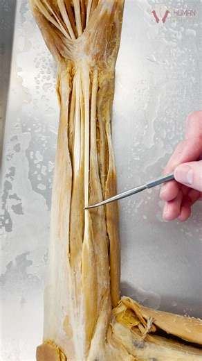 Are YOU missing a muscle?? #evolution #muscles #anatomy #nowyouknow #factsdaily | Institute of Human Anatomy