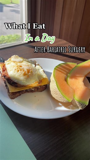 What I Eat in a Day After Gastric Bypass Surgery