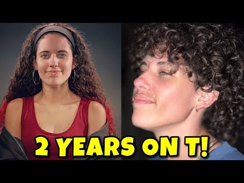 TWO YEARS ON TESTOSTERONE! | #FTM #HRT Update