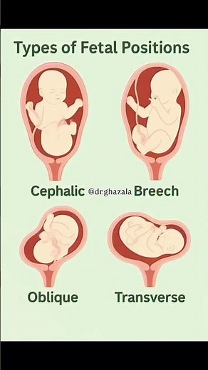 Types of Fetal presentation in mother womb‼️माँ के गर्भ में भ्रूण प्रस्तुति के प्रकार‼️