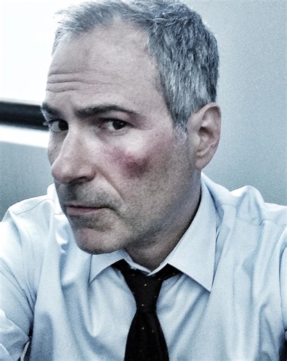 Anthony Arkin | Actor, Editor, Director