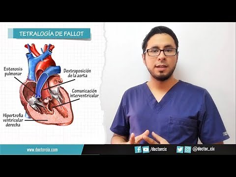 TETRALOGIA DE FALLOT