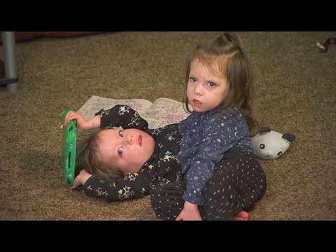 Parents Fought to Save Conjoined Twin Girls