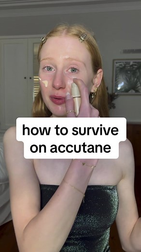 Here’s how to survive on accutane !! #acne #skincare #accutane #accutanejourney #fyp