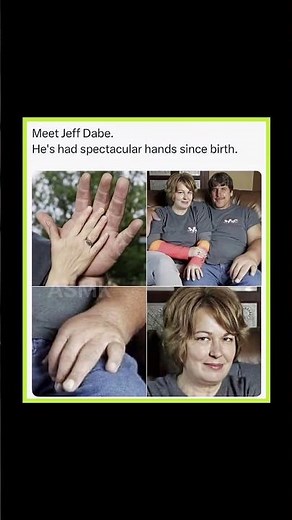 The Man with the World’s Biggest Hands ✋😲 #shorts