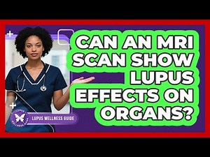 Can An MRI Scan Show Lupus Effects On Organs?