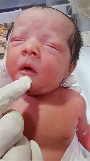 Cute Baby NICU Nursing Care | Good Condition & Recovery #NewbornCareJourney #NICUBaby