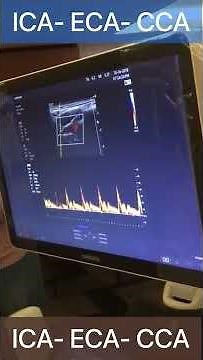 ICA- ECA- CCA Doppler : Technical tips / Arabic