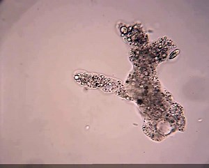 Live Amoeba proteus showing amoeboid movement