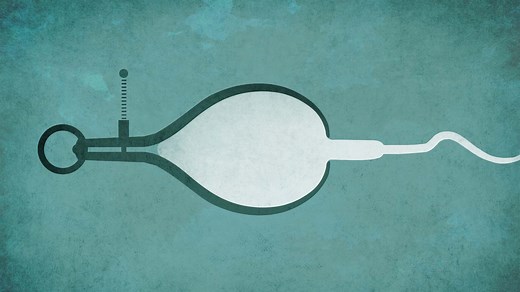 What is Sperm Morphology in my Semen Analysis Results?