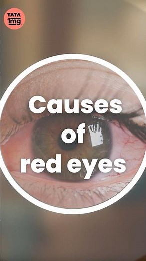 Causes of red eye