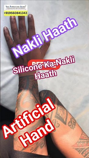 Artificial Hand | Nakli Haath | Fake Hand | Silicone hand Prosthetic #bestclinic #artificialhand