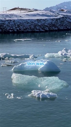 The Man Who Was Frozen Solid… and Survived 😱