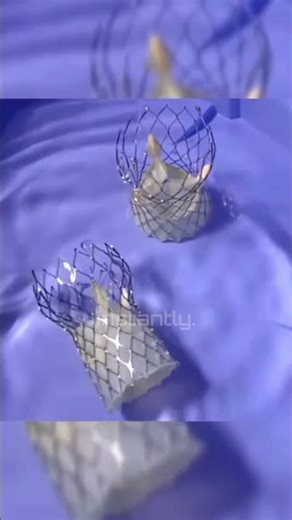 This Metal Spring Moves the Moment It Feels Heat#Innovation #Engineering#FutureTech#Shorts