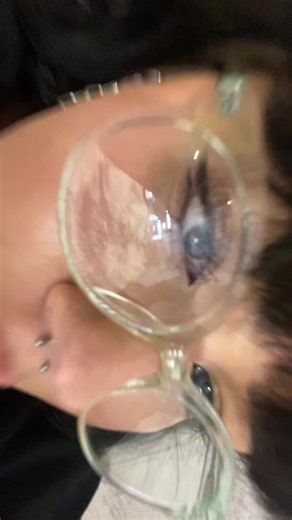Wobbly eye 🥲#fyp