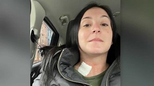 Injection helps woman left with distorted smell for nearly a year after COVID-19