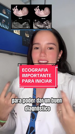 La importancia de la ecografía para saber cómo proseguir y prevenir las enfermedades del embarazo todo tiene un inicio #embarazo #trisomia21 #controlprenatal