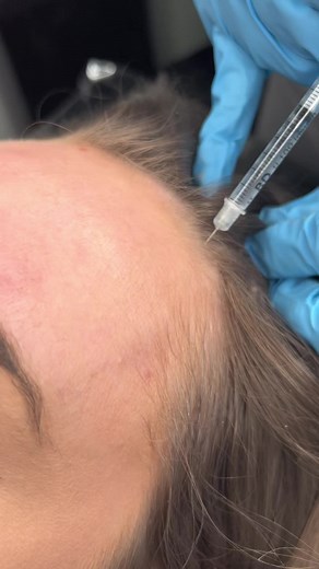 Botox injections in real time ✨