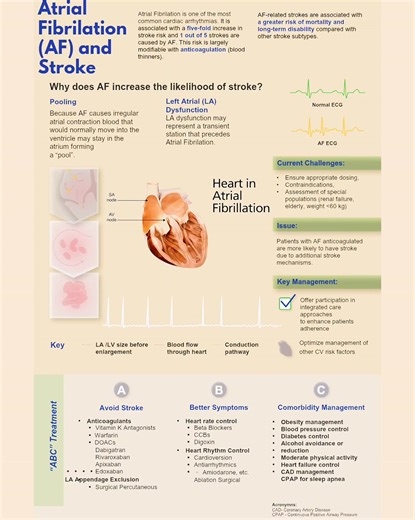 Atrial Fibrillation (AF) and Stroke: Mechanisms and Management #AtrialFibrillation #StrokePrevention #Cardiology #HealthEducation | Abdallah Othman
