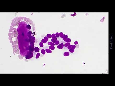 Respiratory Tract Cytology - Unknown Case 7