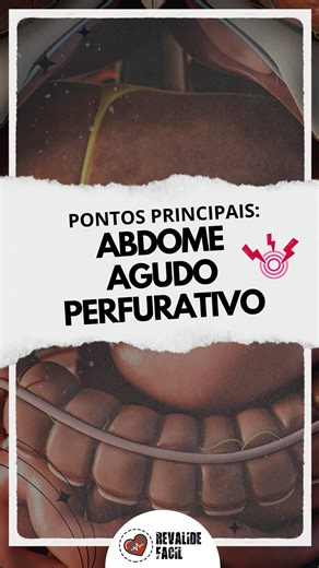 Revalide Fácil 📚 on Instagram: "Vamos revisar os principais pontos sobre o abdome agudo perfurativo? É um baita tema importante pra prática e cai bastante em provas! #medicina #abdomeagudo #aines #usocronico #revalida"