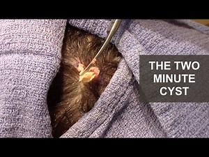 The Two Minute Cyst | Dr. Derm
