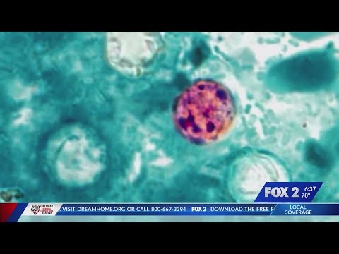 Missouri health officials investigating cases of cyclosporiasis