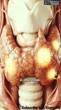 Hyperthyroidism Explained | Overactive Thyroid (T3 & T4) | Symptoms & Causes | FSC Biology