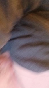 My busted pelvis had 35pieces of bone and the wound you see on my hip here was big enough for surgeon to stick his hand or fist would have fit in it. Thats from getting hit like 110feet by the train in St Charles and helicopter ambulance to st John's mercy hospital saved my life💙 | John Thornton