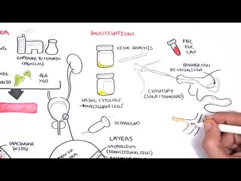 Bladder Cancer Overview types, pathophysiology, diagnosis, treatment