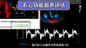 本期讲解来自小羊同学Echo，本人稍加修改，喜欢的朋友去视频号看看