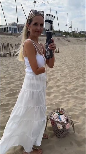 The thief also took away this girl's artificial hand #shortsvideo