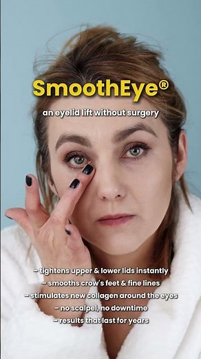 SmoothEye® by Fotona