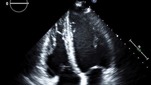 Medical Image AI Analytics with NVIDIA Holoscan