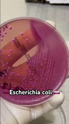 Escherichia coli 🧫🧫🧫🌝🌝#bacteriologia #Microbiologia #LabClinico