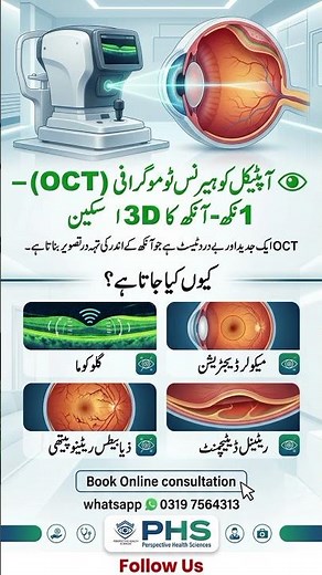 Optical Coherence Tomography (OCT) 3D Eye Scan