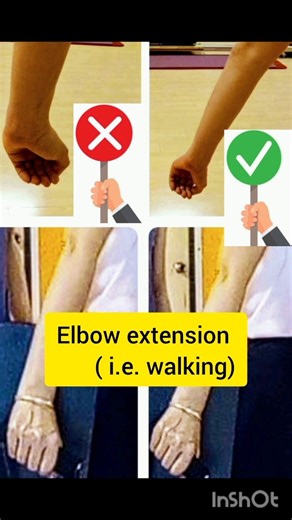 Common wrist kinetic chain biomechanics error --- Radial Deviation