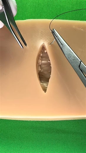 Simple interrupted stitch | Dermhacks